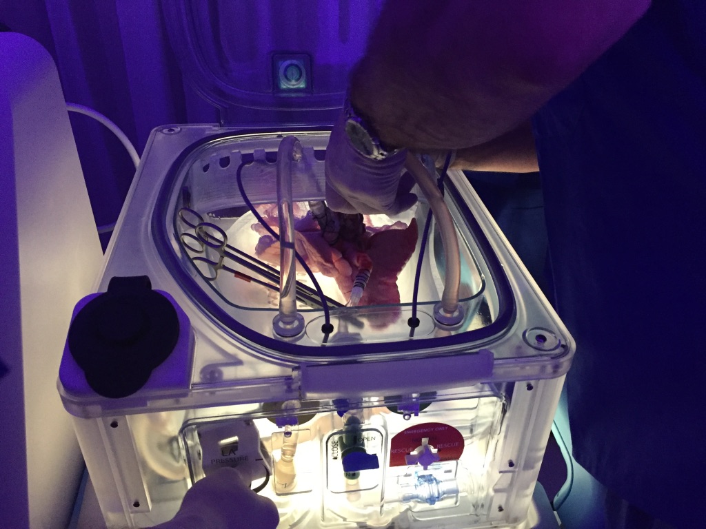 The ‘Lung Capsule’ prototype, XOR Labs Toronto, Toronto, Canada